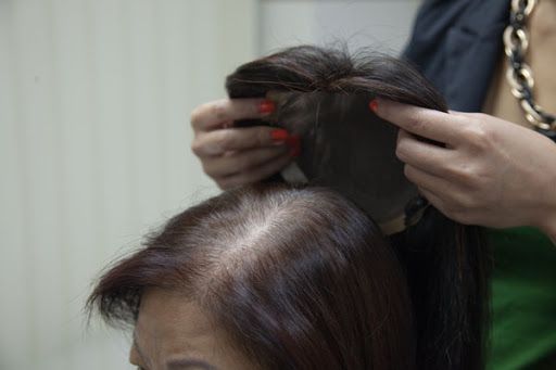 織髮：最簡單的脫髮治療方法？